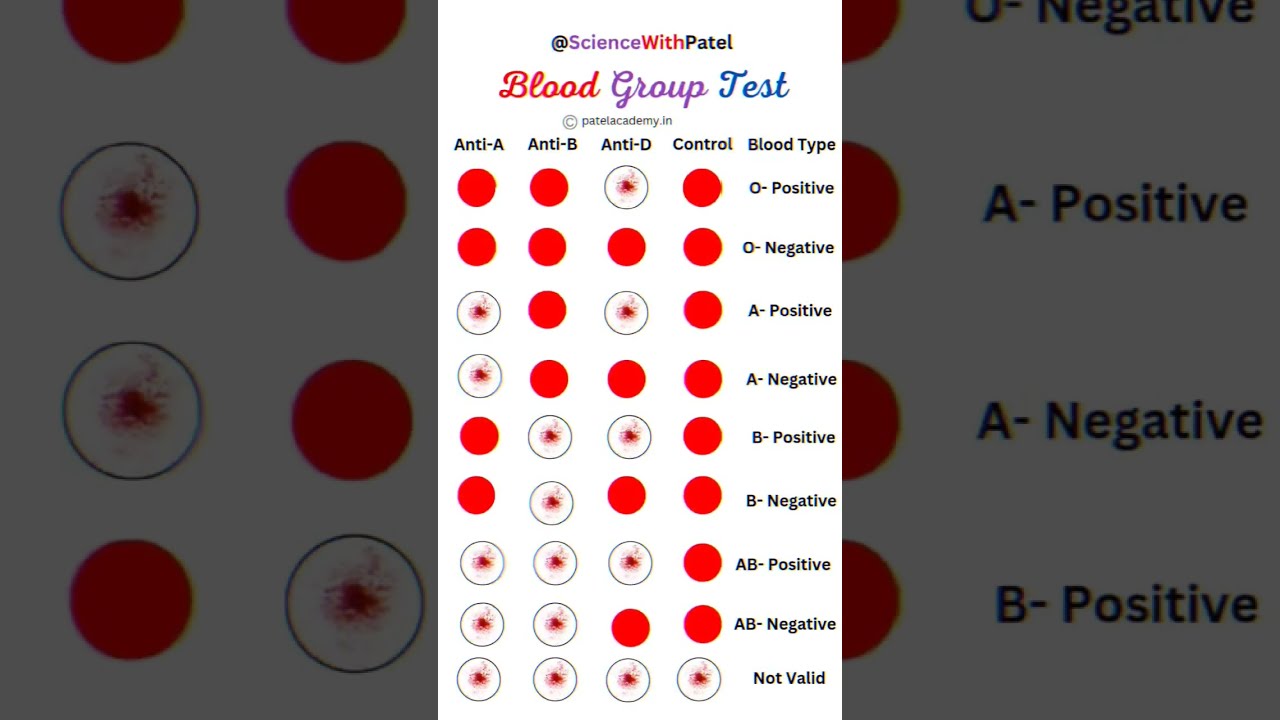 Blood Group Test 