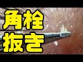 【スッキリ】角栓抜き 総集編 【おまけ付き】Blackheads
