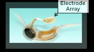 Artificial Retina Update 2011