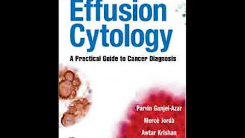 Effusion Cytology: A Practical Guide to Cancer Diagnosis First Edition