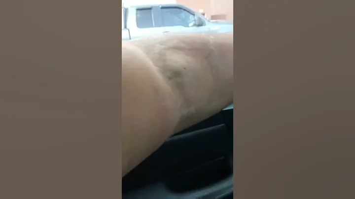 Swell.arm