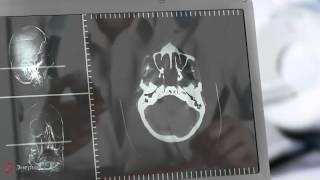 Компьютерная томография головного мозга(Компьютерная томография головного мозга., 2014-10-24T13:40:52.000Z)