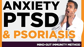 Stress, PTSD, Anxiety, Fatigue, Trauma [Psoriasis] Flares, Inflammation Prevention
