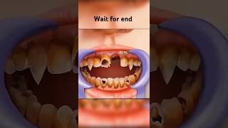 ASMR Dental Transformation!  | Fixing Crooked, Long &amp; Short Teeth | WOW Brain#asmr #animation