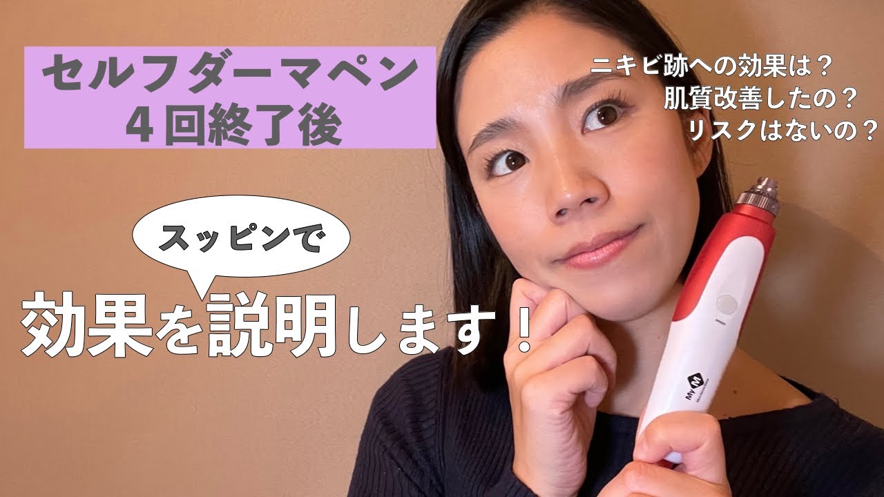 This is what I got good results by getting microneedling at home