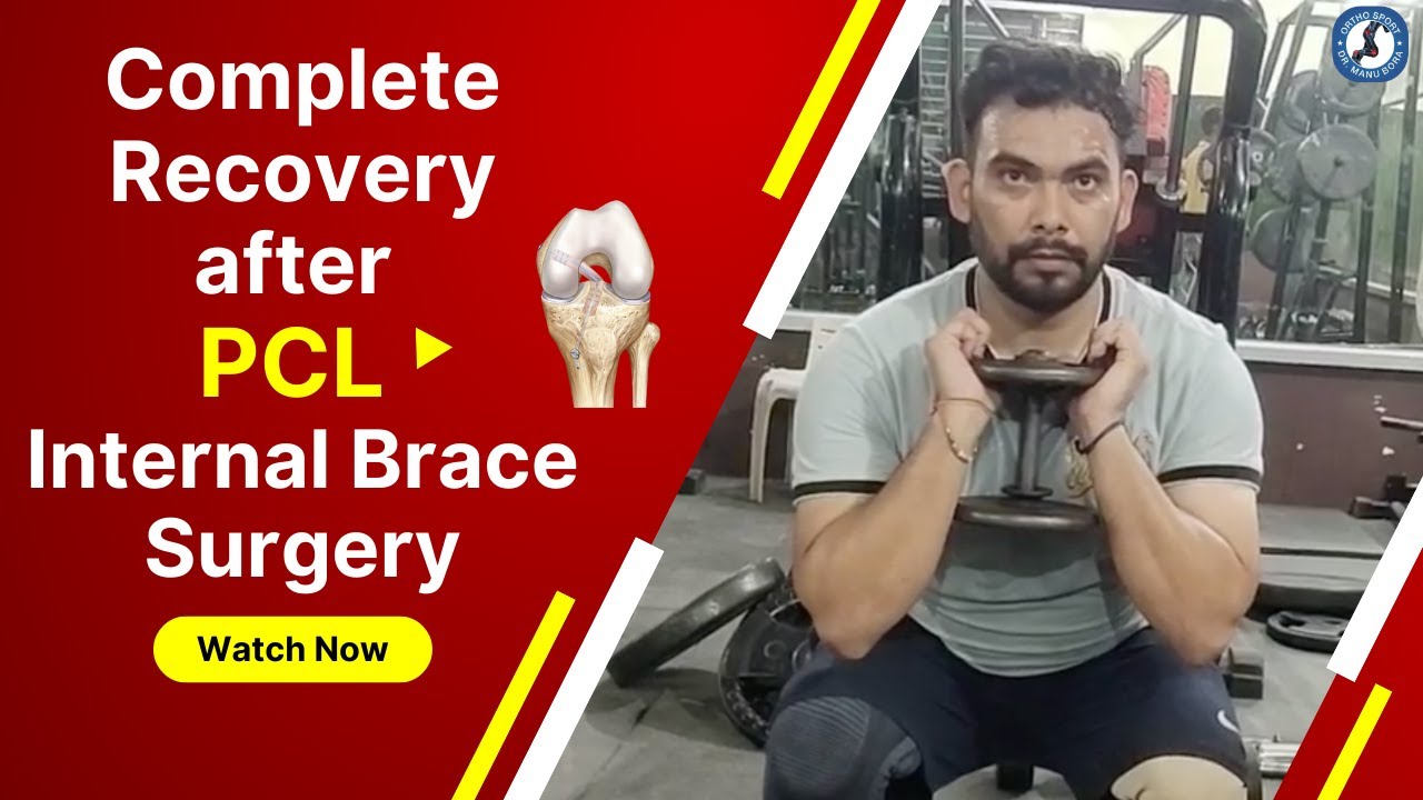 Complete Recovery after PCL Internal Brace Surgery pcl pclrecovery 