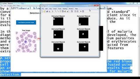 Detection of Malaria Parasites matlab projects | Detection of Malaria Parasites matlab thesis