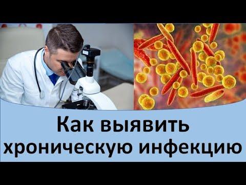 Как выявить хроническую инфекцию