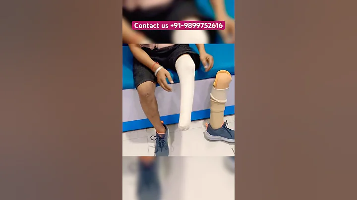 #artificiallimbcenter #ossur #limbcenter #artificiallimb #belowkneeprosthesis #prostheticlimb