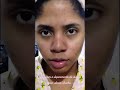 Linha completa no combate a acne e manchas da pele#skincare #marykay #atelier