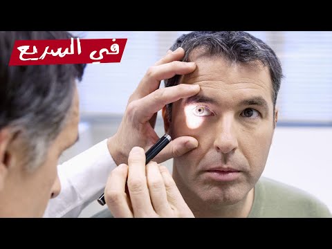 ليه الدكتور بينور بالكشاف في عين المرضى وهو بيكشف عليهم في السريع