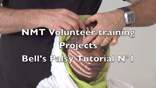 nmt volunteer training projects bell s palsy tutorial n 1