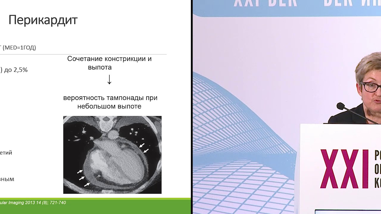 Боли после лучевой терапии