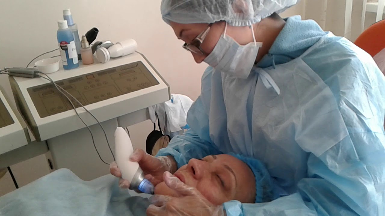 Ультра звуковая вакуумная чистка лица. - YouTube