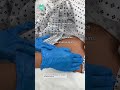 5 Must-Know NCLEX Facts for Postpartum Infections 🤱