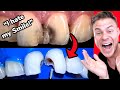 Real Orthodontist Reacts! Crazy Dental Transformation Makes Patient Smile Again!