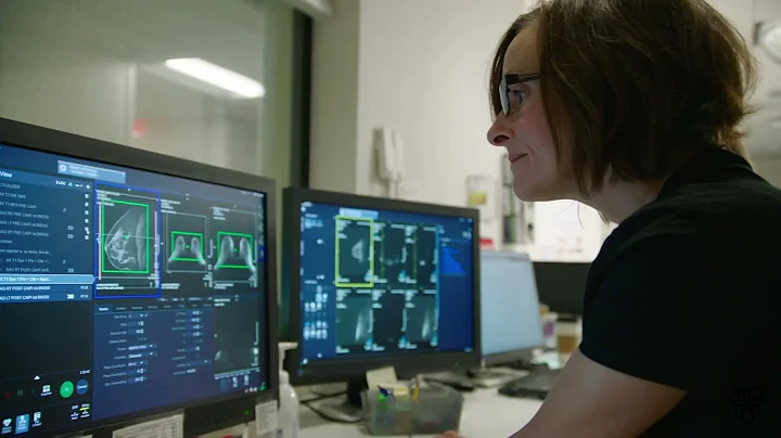 Mayo Clinic Minute - The importance of supplemental screenings for dense breasts