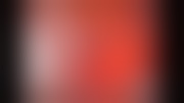 Endoscopic components separation for loss of domain ventral hernia