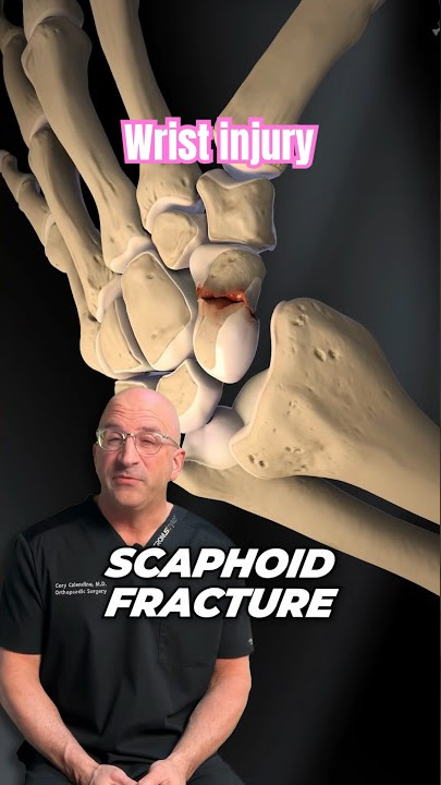 Frequently Misdiagnosed Reason Your Wrist Hurts #shorts