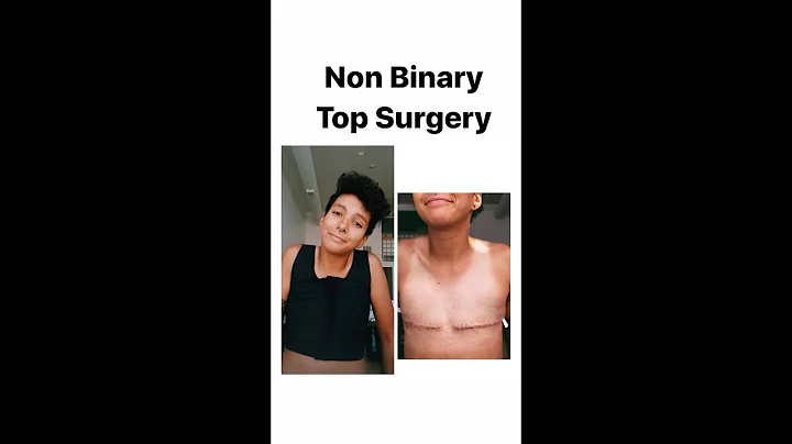 Non-Binary Top Surgery with Dr Kenneth Wolf