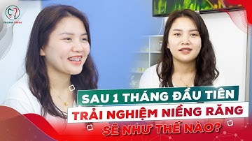 Trải Nghiệm Thực Tế Khách Hàng Sau 1 Tháng Niềng Răng Sẽ Thế Nào?
