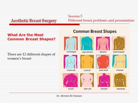 Breast different shapes Ahmed Ali Hassan, MD 