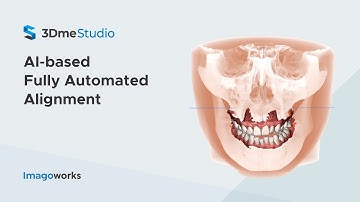 AI-based Fully Automated Alignment | Imagoworks Technology (2021 Jul)