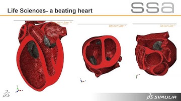 SIMULIA Abaqus - Life Sciences