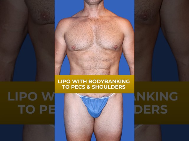 Can't Lose Love Handles? Here's What Actually Works / Dr Steinbrech / Male Plastic Surgery