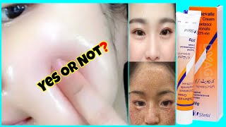 Clobevate cream for skin whitening Work or Not? Zara Beauty Tips