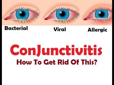 What Is How To Get Rid Out Of This English YouTube Hqdefault