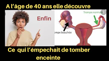 Quel maladie empêche de tomber enceinte