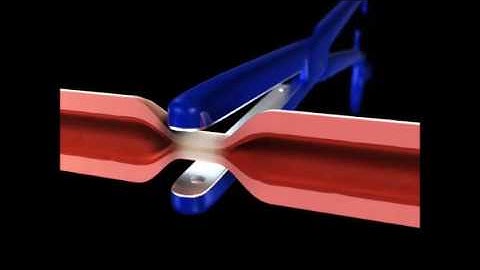 marClamp® – Features and functions