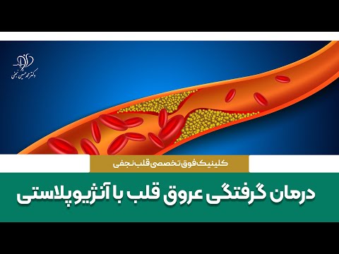 تصویری: آنژیوپلاستی چه زمانی انجام می شود؟