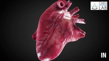 Focused ultrasound combined with microbubble-mediated intranasal delivery