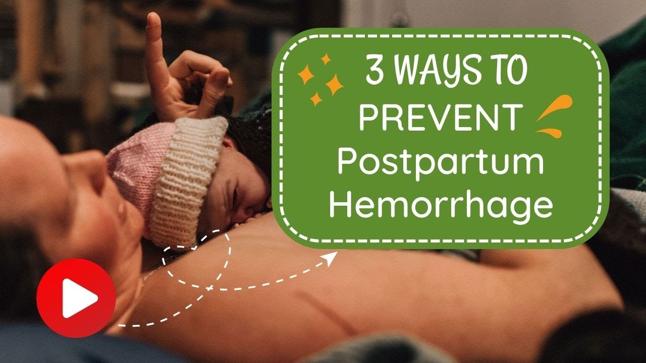 3 Ways To Prevent Postpartum Hemorrhage YouTube 3 Ways To Prevent Postpartum Hemorrhage YouTube