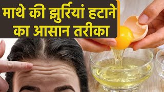 माथे की झुर्रियां कैसे हटाएं | माथे की झुर्रियां हटाने के उपाय | Boldsky *health