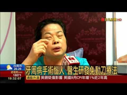 牙周病手術惱人 醫生研發免動刀療法 初期勿輕忽 感到疼痛時恐掉牙