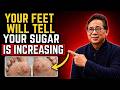 Your Feet Are WARNING You About Diabetes — 9 Signs Seniors Should Never Ignore