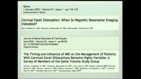 Dr.Sami Aleissa - Cervical facet fractures