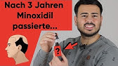 Erfahrung Mit Alpecin Shampoo Und Liquid Youtube