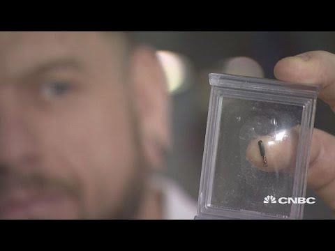 Microchipping staff: A matter of when, not if | The Edge
