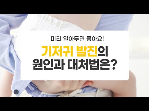 [맘스홀릭베이비] 기저귀 발진의 원인과 대처법은?