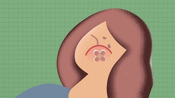 Sliding Fee Explainer Animated Video for Healthcare Client | HenkinSchultz