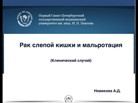 Клинический случай: Рак слепой кишки и мальротация