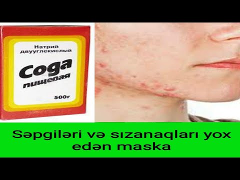 Soda üzdəki səpgiləri və sızanaqları yox edir.