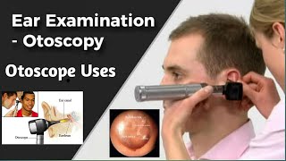 Ear Examination and Otoscopy|| How To Use || How To Purchase Otoscope Device #Otoscope ke fyde