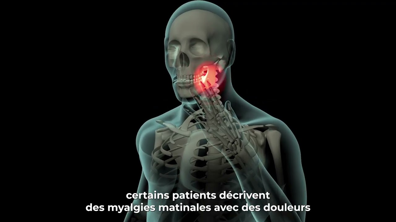 Le Bruxisme nocturne : échanges entre un dentiste et un kinésithérapeute