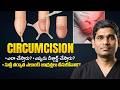 How is Circumcision Done? | Circumcision Benefits Side Effects Precautions| Treatment Range Hospital
