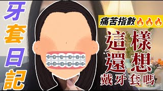 【牙套日記1】牙齒矯正大公開恐怖拔牙記矯正清潔小撇步